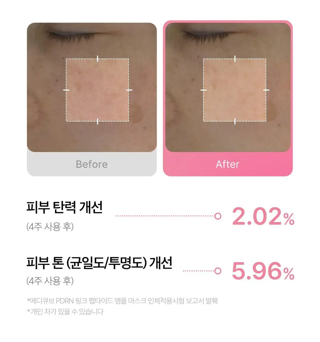 [NEW/붙이는앰플] 메디큐브 PDRN 핑크 펩타이드 앰플 마스크 1매 상세페이지 21
